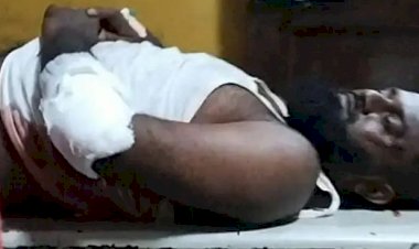 ಹಾಡುಹಗಲೇ ಚಾಕುವಿನಿಂದ ಚುಚ್ಚಿದ ಗಾಂಜಾ ಮತ್ತಿನ ಮಂದಿ-ವ್ಯಕ್ತಿ ಗಂಭೀರ