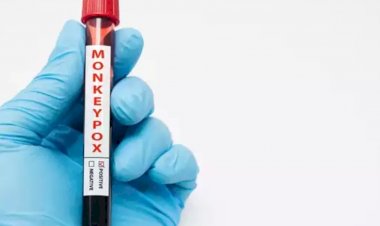 ದಿಲ್ಲಿಯಲ್ಲಿ 5ನೇ ಮಂಕಿಪಾಕ್ಸ್ ಪ್ರಕರಣ: ನೈಜೀರಿಯಾದಿಂದ ಬಂದ ಮಹಿಳೆಗೆ ಸೋಂಕು