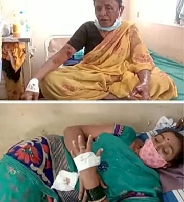 ಧಾರವಾಡ: ಕವಲಗೇರಿಗೆ ಚಿರತೆ ಕಮ್ ಬ್ಯಾಕ್- ಇಬ್ಬರ ಮೇಲೆ ದಾಳಿ